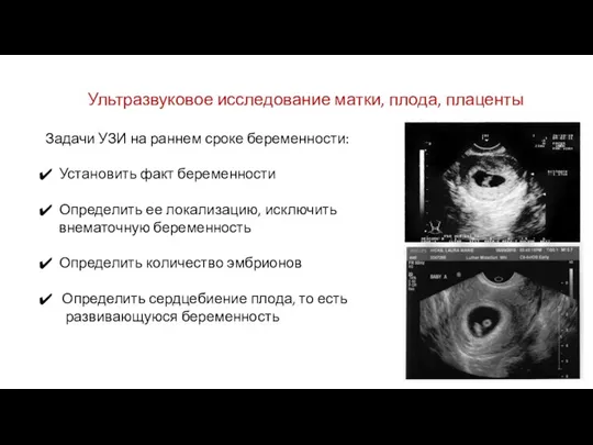 Ультразвуковое исследование матки, плода, плаценты Задачи УЗИ на раннем сроке