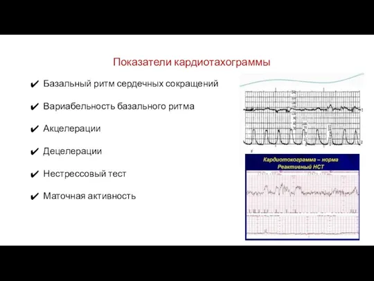 Показатели кардиотахограммы Базальный ритм сердечных сокращений Вариабельность базального ритма Акцелерации Децелерации Нестрессовый тест Маточная активность