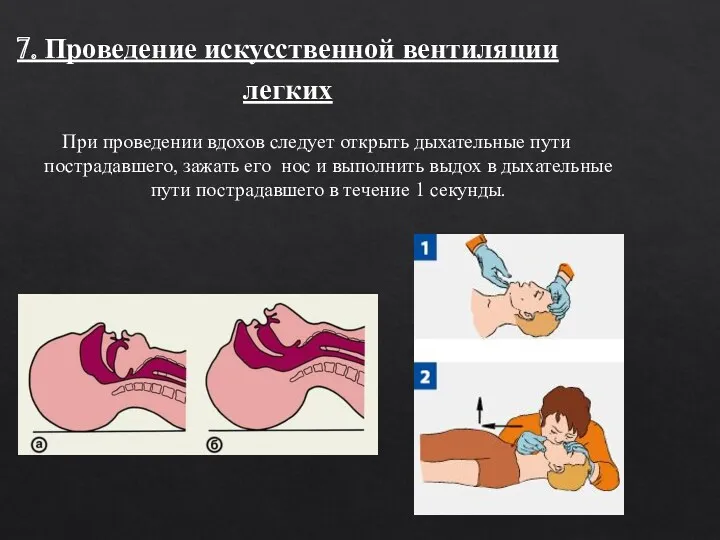 7. Проведение искусственной вентиляции легких При проведении вдохов следует открыть