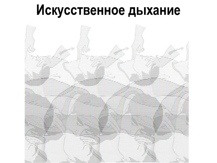 Искусственное дыхание