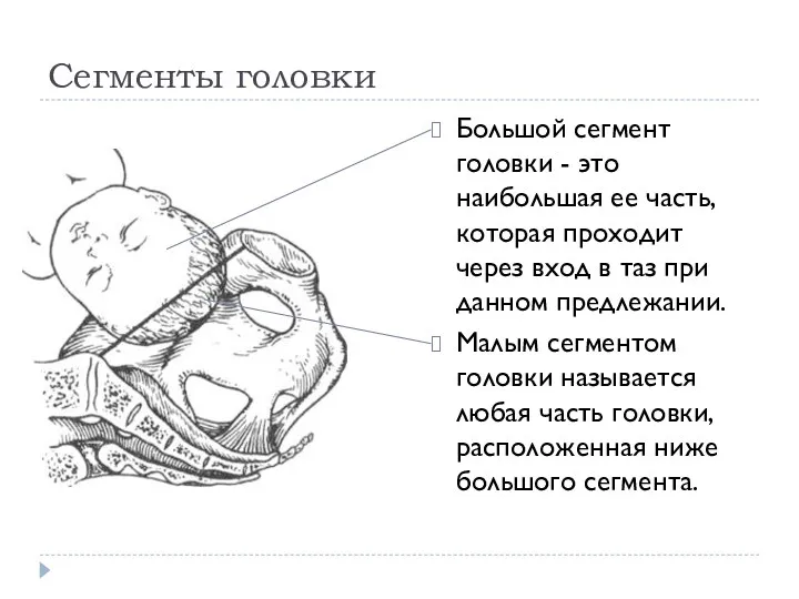 Сегменты головки Большой сегмент головки - это наибольшая ее часть,