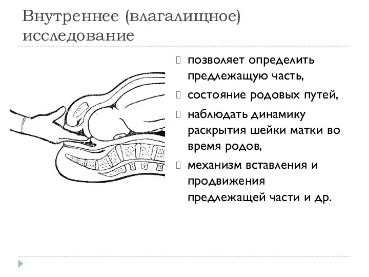 Внутреннее (влагалищное) исследование позволяет определить предлежащую часть, состояние родовых путей,