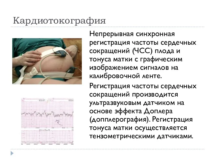 Кардиотокография Непрерывная синхронная регистрация частоты сердечных сокращений (ЧСС) плода и