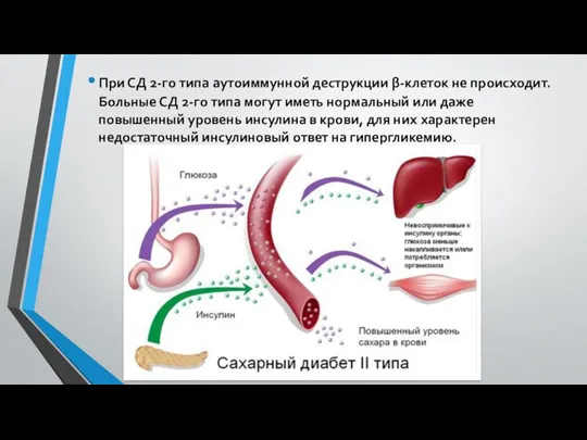 При СД 2-го типа аутоиммунной деструкции β-клеток не происходит. Больные