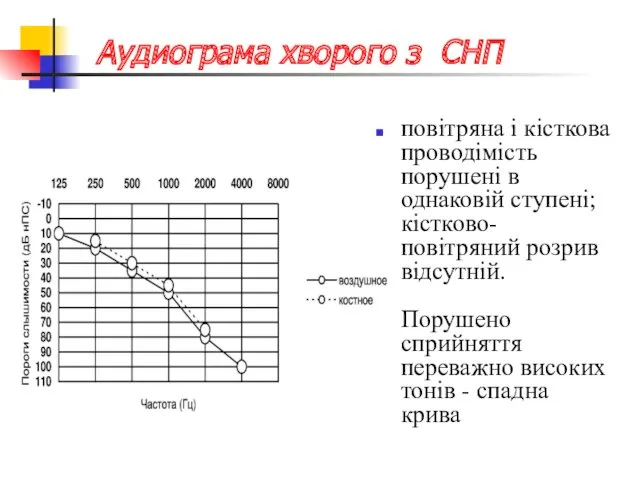 Aудиограмa хворого з СНП повітряна і кісткова проводімість порушені в