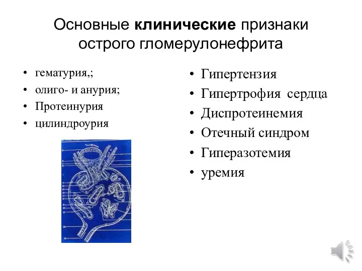 Основные клинические признаки острого гломерулонефрита гематурия,; олиго- и анурия; Протеинурия