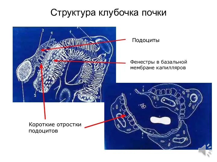 Структура клубочка почки Фенестры в базальной мембране капилляров Подоциты Короткие отростки подоцитов