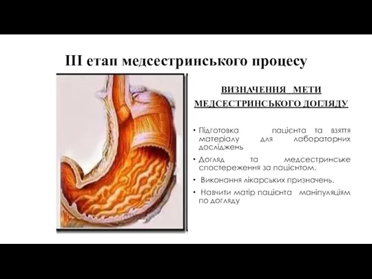 ІІІ етап медсестринського процесу ВИЗНАЧЕННЯ МЕТИ МЕДСЕСТРИНСЬКОГО ДОГЛЯДУ Підготовка пацієнта