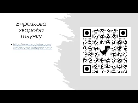 Виразкова хвороба шлунку https://www.youtube.com/watch?v=nK1nsNTpbic&t=9s