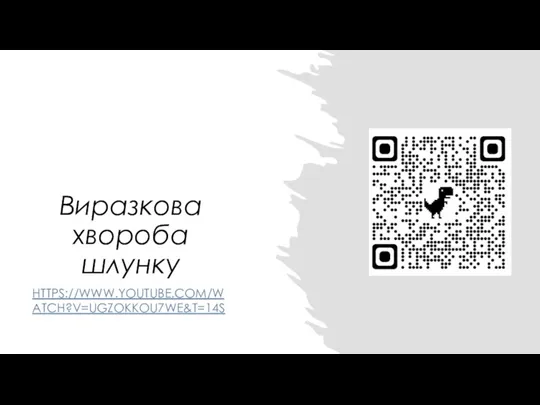 Виразкова хвороба шлунку HTTPS://WWW.YOUTUBE.COM/WATCH?V=UGZOKKOU7WE&T=14S