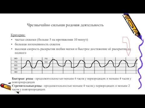 Чрезвычайно сильная родовая деятельность Критерии: частые схватки (больше 5 на