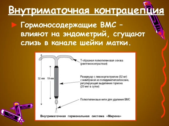 Внутриматочная контрацепция Гормоносодержащие ВМС – влияют на эндометрий, сгущают слизь в канале шейки матки.