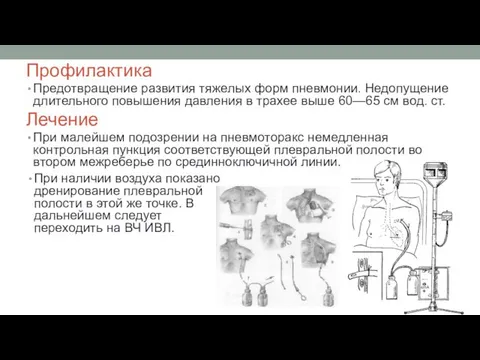 Профилактика Предотвращение развития тяжелых форм пневмонии. Недопущение длительного повышения давления