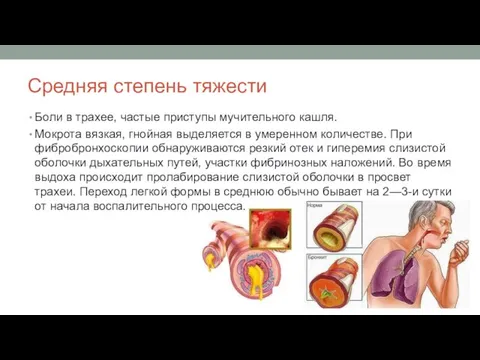 Средняя степень тяжести Боли в трахее, частые приступы мучительного кашля.