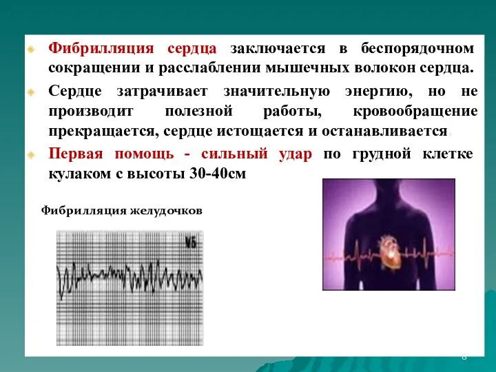 Фибрилляция сердца заключается в беспорядочном сокращении и расслаблении мышечных волокон