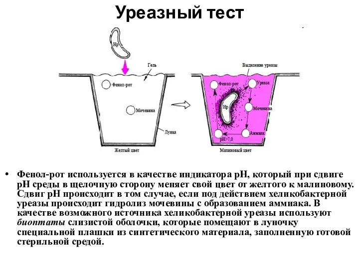 Уреазный тест Фенол-рот используется в качестве индикатора рН, который при