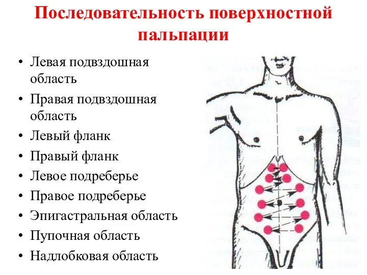 Последовательность поверхностной пальпации Левая подвздошная область Правая подвздошная область Левый