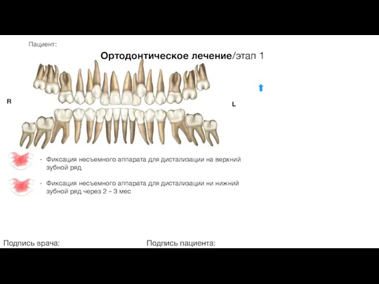 Пациент: Ортодонтическое лечение/этап 1 Подпись врача: Подпись пациента: R L