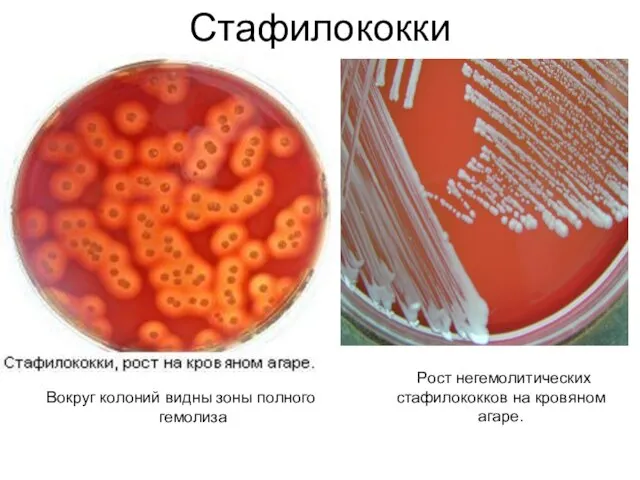 Стафилококки Вокруг колоний видны зоны полного гемолиза Рост негемолитических стафилококков на кровяном агаре.