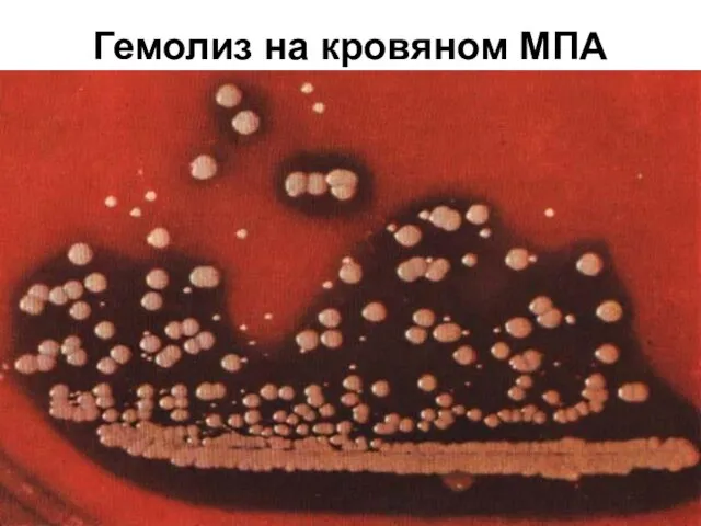 Гемолиз на кровяном МПА