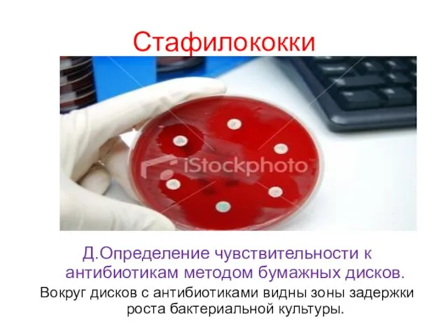 Стафилококки Д.Определение чувствительности к антибиотикам методом бумажных дисков. Вокруг дисков с антибиотиками видны