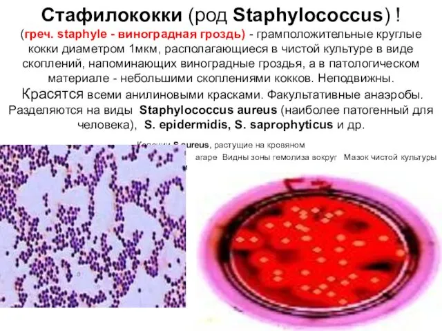 Стафилококки (род Staphylococcus) ! (греч. staphyle - виноградная гроздь) - грамположительные круглые кокки