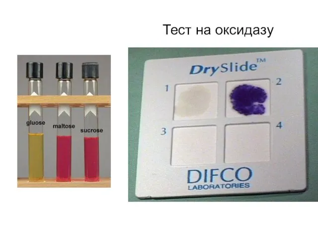 Тест на оксидазу