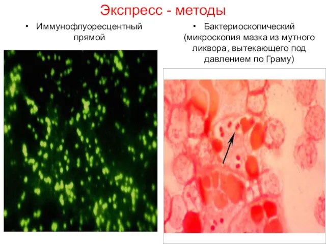 Экспресс - методы Иммунофлуоресцентный прямой Бактериоскопический (микроскопия мазка из мутного ликвора, вытекающего под давлением по Граму)