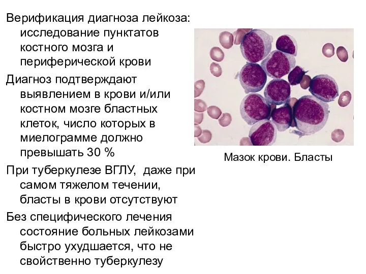 Верификация диагноза лейкоза: исследование пунктатов костного мозга и периферической крови