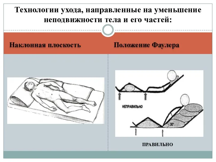 Наклонная плоскость Положение Фаулера Технологии ухода, направленные на уменьшение неподвижности тела и его частей: ПРАВИЛЬНО