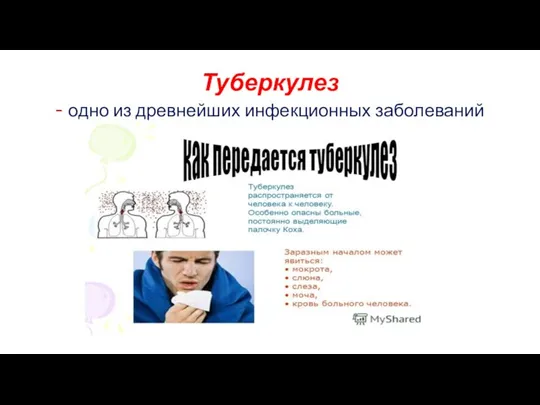 Туберкулез - одно из древнейших инфекционных заболеваний