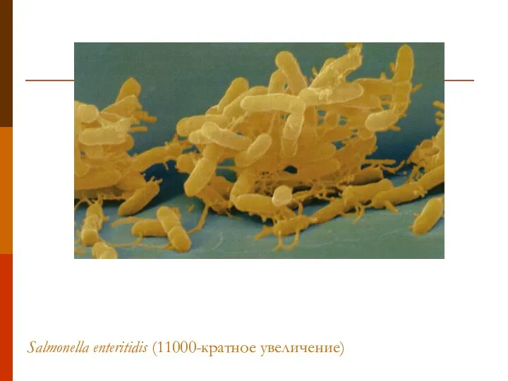 Salmonella enteritidis (11000-кратное увеличение)