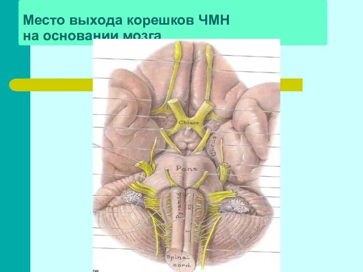 Место выхода корешков ЧМН на основании мозга