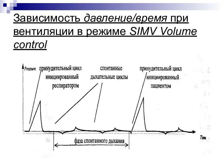 Зависимость давление/время при вентиляции в режиме SIMV Volume control