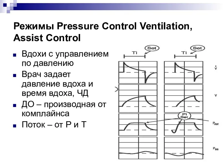 Режимы Pressure Control Ventilation, Assist Control Вдохи с управлением по