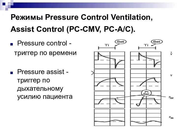 Режимы Pressure Control Ventilation, Assist Control (PC-CMV, PC-A/C). Pressure control