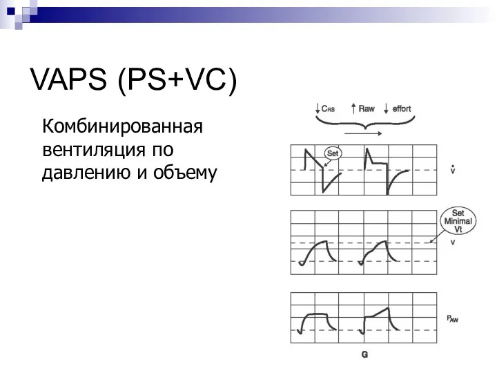 VAPS (PS+VC) Комбинированная вентиляция по давлению и объему