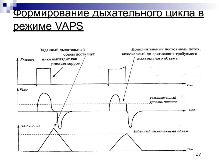 Формирование дыхательного цикла в режиме VAPS