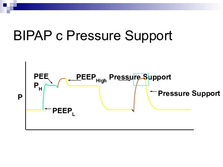 BIPAP с Pressure Support PEEPHigh Pressure Support P PEEPL PEEPH Pressure Support
