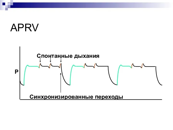 APRV Синхронизированные переходы Спонтанные дыхания P