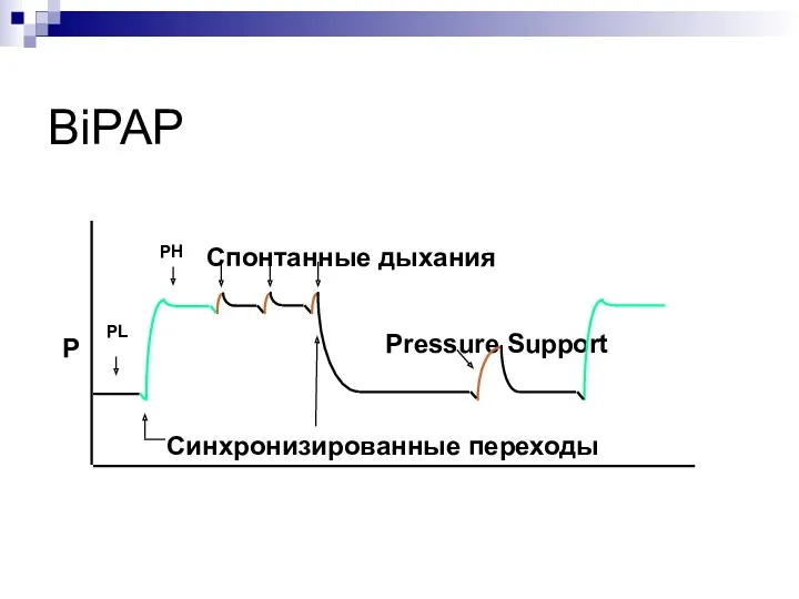 BiPAP Синхронизированные переходы Спонтанные дыхания P Pressure Support PL PH