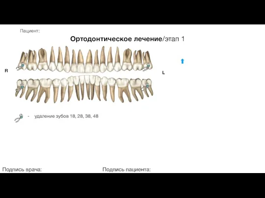 Пациент: Ортодонтическое лечение/этап 1 Подпись врача: Подпись пациента: R L