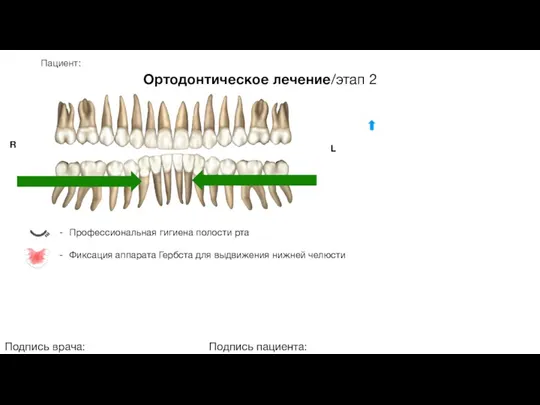 Пациент: Ортодонтическое лечение/этап 2 Подпись врача: Подпись пациента: R L