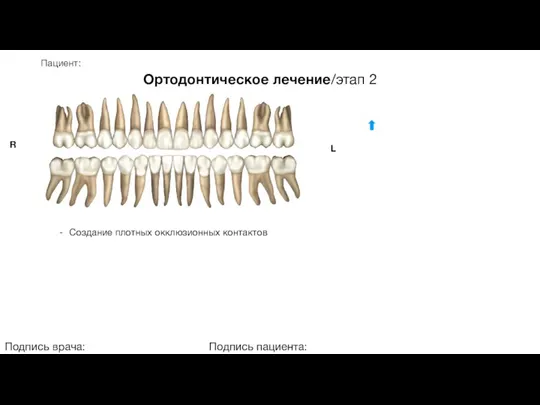 Пациент: Ортодонтическое лечение/этап 2 Подпись врача: Подпись пациента: R L Создание плотных окклюзионных контактов