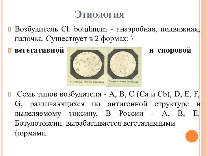 Этиология Возбудитель Cl. botulinum - анаэробная, подвижная, палочка. Существует в