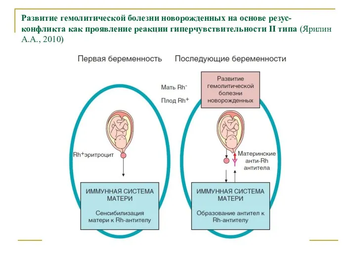 Развитие гемолитической болезни новорожденных на основе резус-конфликта как проявление реакции гиперчувствительности II типа (Ярилин А.А., 2010)