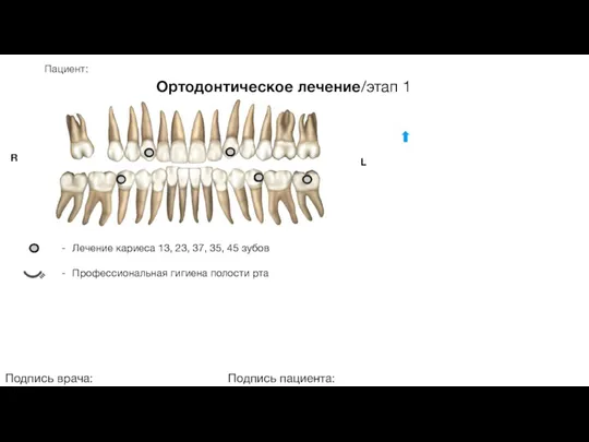 Пациент: Ортодонтическое лечение/этап 1 Подпись врача: Подпись пациента: R L Лечение кариеса 13,