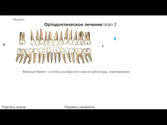 Пациент: Ортодонтическое лечение/этап 2 Подпись врача: Подпись пациента: R L - Фиксация брекет