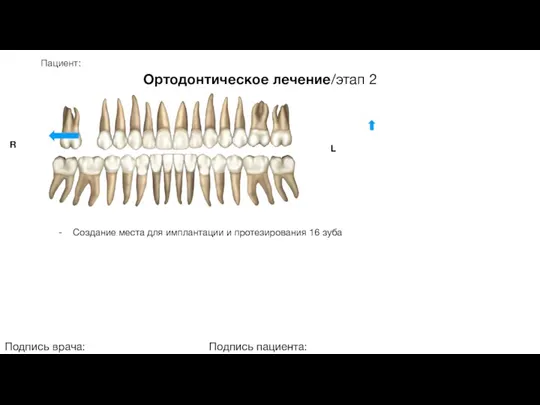 Пациент: Ортодонтическое лечение/этап 2 Подпись врача: Подпись пациента: R L - Создание места