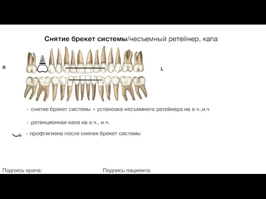 Снятие брекет системы/несъемный ретейнер, капа Подпись врача: Подпись пациента: R